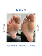 ピーアンドオー(P&O)/