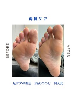 ピーアンドオー(P&O)/