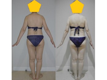 アルマ 芦屋(ALMA)/3ヶ月の変化☆180分10回☆60代