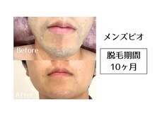 メンズビオ 神戸三宮店/