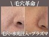 《毛穴革命パーフェクトコース》毛穴洗浄+炭酸パック+水光注入 ¥30800→¥9800