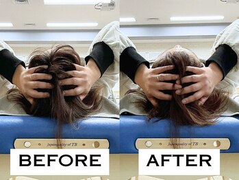 ビハリスト 新宿マルイ本館/頭のサイズからしっかり小顔に♪