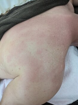 リデザイン 京都(REDESIGN)/REDESIGN京都中医施術法