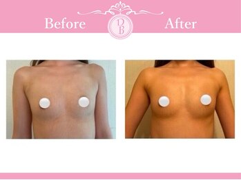 デミーナ(Demyna)/