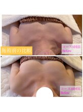 シェリーココ(cherie CoCo)/施術前比較♪定着の証拠♪