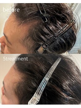 カラーズ(COLOURS)/プロセルセラピーズ頭皮