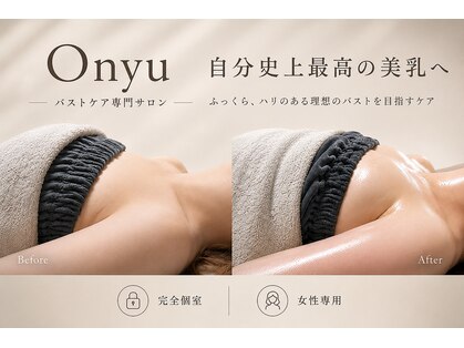 オンユ(Onyu)の写真