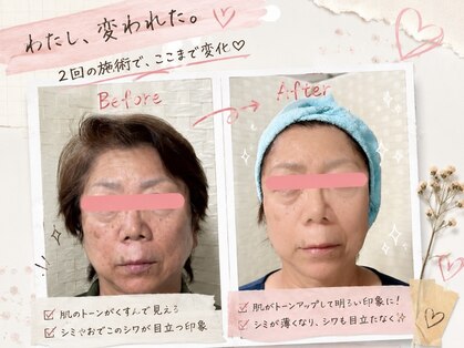 ケイ エムワン(K M1)の写真