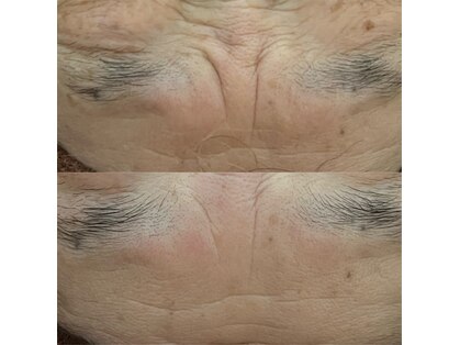 ビー イオンモール小山店(Be...)の写真