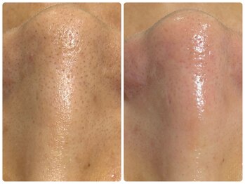 アウラプラス(Aura+)/