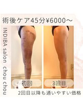 シュシュ/術後ケアもお任せください！