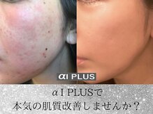 エーアイプラス(αI PLUS)