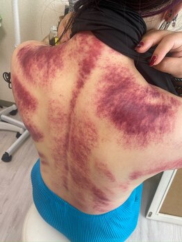 コル コルエ(koru korue)/血の色が悪すぎる!!