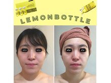 ドマーニ(Domani)の雰囲気（お顔の表情筋に働きかけるテラボーラー＆レモンボトル）