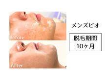 メンズビオ 神戸三宮店/