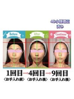 小顔整体研究所 KSラボ 新潟中山店/