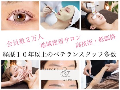 エステティックティアリィ サンマルシェ高蔵寺店(TiARY)の写真