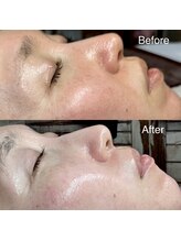 シロ(siro)/韓国水光肌・美白フェイスWax