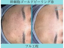 リメイククリニカルビューティー(Remake clinical beauty)/