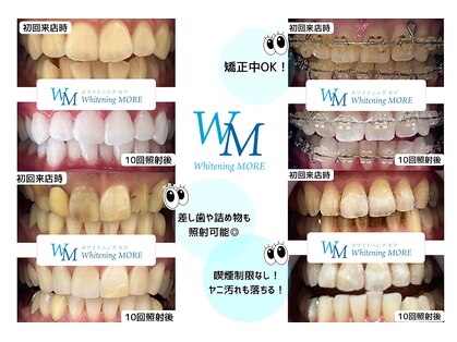 ホワイトニング モア(Whitening MORE)の写真