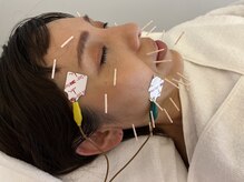 さくら治療院くまもと/お悩みの小顔・むくみ・目元乾燥