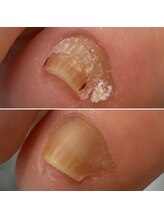 ニマ(nima)/副爪のケアもお任せください