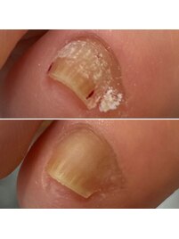 副爪のケアもお任せください