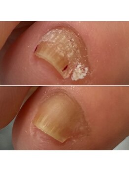 ニマ(nima)/副爪のケアもお任せください