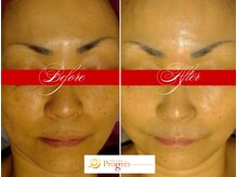 エステティックルームプログレス(Esthetic Room Progres)の雰囲気（老化肌、シミシワ、くすみ、たるみ、乾燥、ゆるみでお悩みの方に）