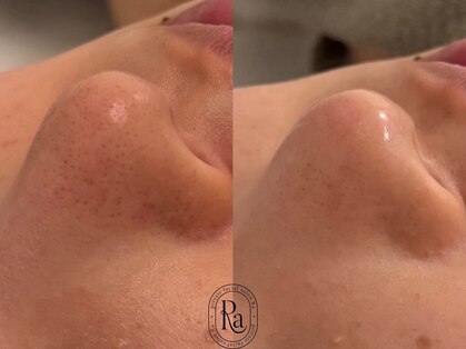 アールエーサロン 恵比寿 広尾(Ra salon)の写真