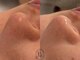 アールエーサロン 恵比寿 広尾(Ra salon)の写真