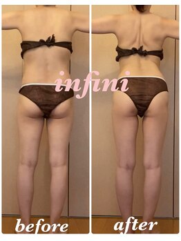 アンフィニ(infini)/短期集中全身10回コース(3ヶ月)