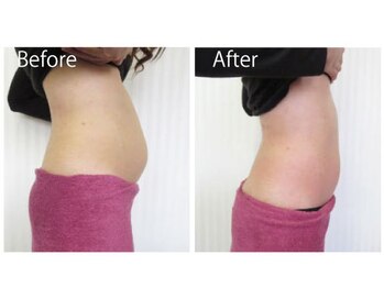 ライトウェーブ 松本村井本店/20代　ぽっこりお腹が劇的変化！