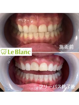 ルブラン 奈良店(Le Blanc)/30代女性のお客様