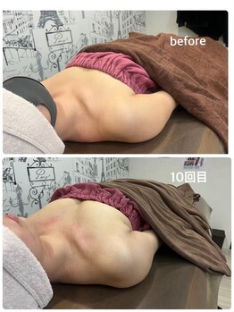 ロココ 岐阜店(Rococo)/10回目の変化のお写真