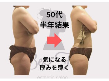 ビーフォー(be for)/50代　１０回コース結果