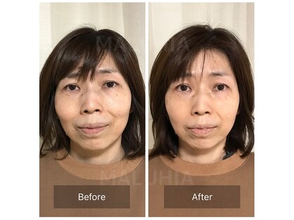 マルヒアの写真