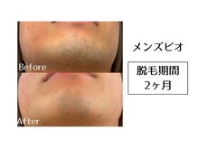 メンズビオ 神戸三宮店/