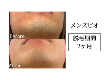 メンズビオ 神戸三宮店/