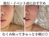 【aika限定】即効性抜群◎お顔のむくみとりの小顔フェイシャル ￥12,900