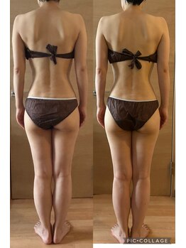 シエスタ リラクゼーションアンドデトックス(Siesta Relaxation&Detox)/40代後半お客様のBefore&After