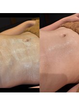 シノ 銀座(shino)/背中とお腹も◎