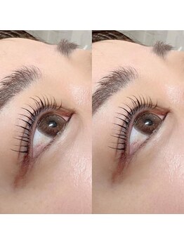 バニーアイズ 天神(Bunny eyes TENJIN)/トリートメントラッシュリフト