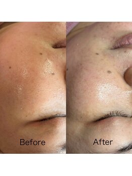 シロ(siro)/韓国水光肌・美白フェイスWax