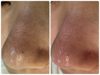 サイセイ(SAISEI)/