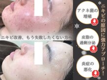 エピア 岡崎店(Epia)