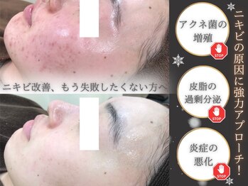 エピア 岡崎店(Epia)