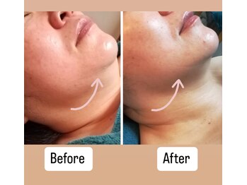 ダイエット サポート(DIET SUPPORT)/ブライダルにもオススメ