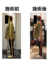 スタイルフリー/60代女性腰痛