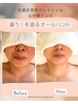 マリーゴールド(marigold)の写真/【毛穴撲滅！陶器肌☆90分¥8600】でエイジングケア◆高品質/高濃度/技術にこだわる美追求サロン♪